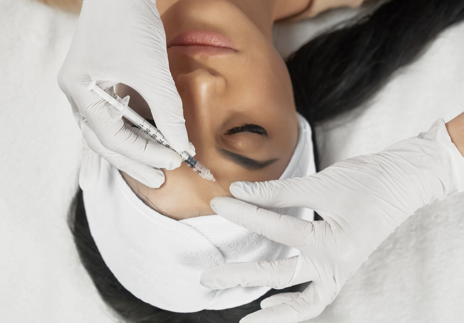 Botox for migraines